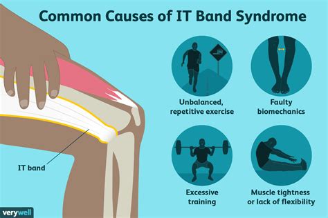 itb syndrome treatment